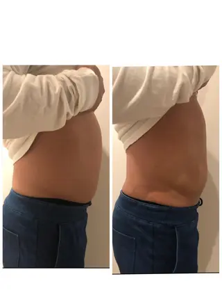 体の中から肌質改善 クレール 奈良のエステ・リラクイメージ