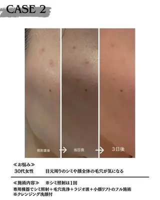 素肌育成・シミケア専門サロン美潤-miulu-所属・【医療提携サロン】 【シミケア専門】のエステ・リラクイメージ