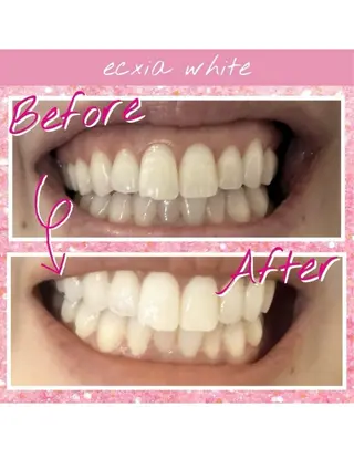 セルフホワイトニングサロン　エクシアホワイト西尾店所属・エクシアホワイト西尾 堀内恵のその他イメージ