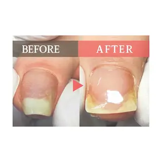 北千住巻き爪矯正院フルフィル所属・北千住巻き爪矯正院 フルフィルのネイルデザイン