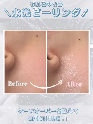 レイビス盛岡店 ♡吉田♡のエステ・リラクイメージ