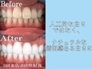 メンズ ホワイトニングカフェ藤が丘店所属・ホワイトニングカフェ 藤が丘のその他イメージ