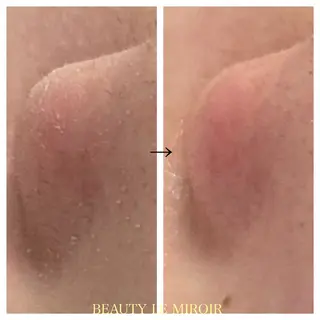 ビューティー ミロワールのエステ・リラクイメージ