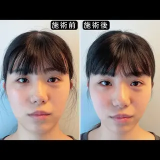 渋谷 小顔美容鍼 専門サロン YZのエステ・リラクイメージ