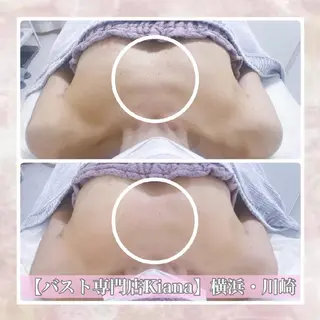 【バスト専門店 】 Kiana のエステ・リラクイメージ