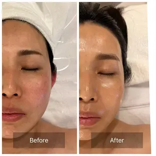 mine.mマインエム所属・mine.mi マインエムのエステ・リラクイメージ