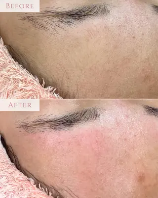 肌質改善専門サロン Bellmi/心斎橋のエステ・リラクイメージ