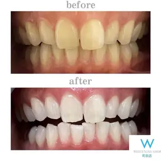 メンズ キッズ ホワイトニングショップ町田店所属・ホワイトニング ショップ町田店のその他イメージ