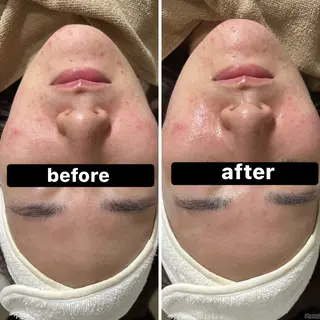 脱毛＆Beauty salon IILA所属・垢抜けお手伝い💖 Sakuraの眉毛・アイブロウイメージ