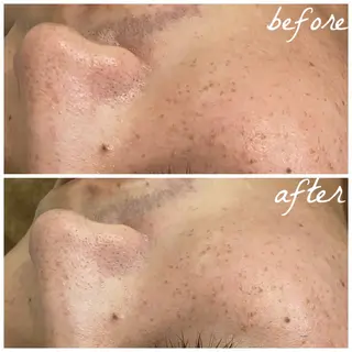 メンズ メナード岐阜市茜部 杉浦のエステ・リラクイメージ