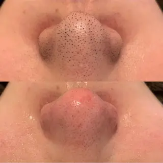 BELCIA福岡店　récolte de BELCIA（レコルトデベルシア）所属・BELCIA福岡店 レコルトデベルシアのエステ・リラクイメージ