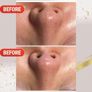 ピーリング専門店 Belluteのエステ・リラクイメージ