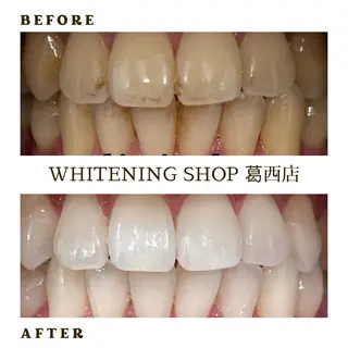 メンズ ホワイトニング ショップ葛西店のその他イメージ