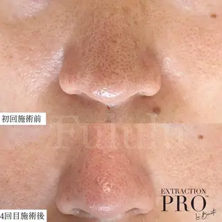 毛穴専門サロン　フルール所属・フルールFululu 自由が丘のエステ・リラクイメージ