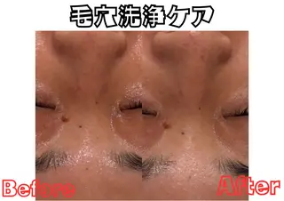 POLA　VIVID所属・安藤 有里のエステ・リラクイメージ