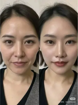 ネイル aliaハイフ&水光ジェットサロン所属・aliaハーブ水光店 エステティシャン募集のエステ・リラクイメージ