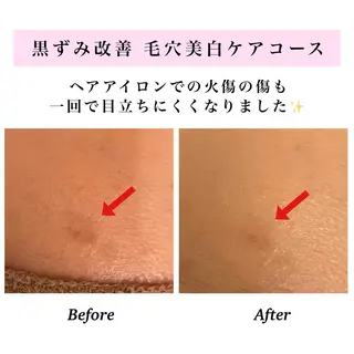 Bellesthe （ベルエステ）のエステ・リラクイメージ