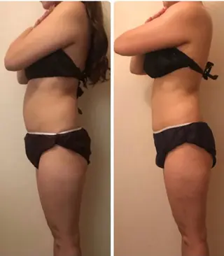 le  bourgeon所属・le bourgeonのエステ・リラクイメージ