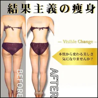 Julien千葉店所属・痩身エステ✨ Julien千葉店✨のエステ・リラクイメージ