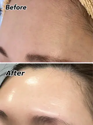 EstheticSalonReTweet所属・竹谷 春希のエステ・リラクイメージ