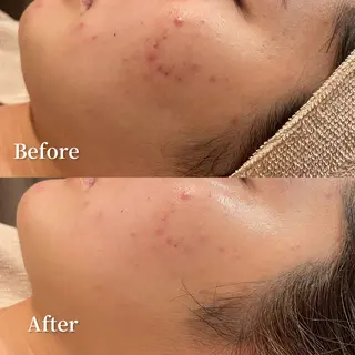 /ulu  soin所属・太田 玲奈のエステ・リラクイメージ