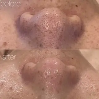 【しみ毛穴専門店】beautysalon Ankh所属・しみ毛穴専門店 Ankh 平田のエステ・リラクイメージ