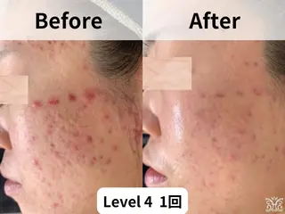 【ハーブピーリング&アロマリンパマッサージ nana】医療提携サロン所属・美肌&アロマ🌸 nana 中目黒のエステ・リラクイメージ