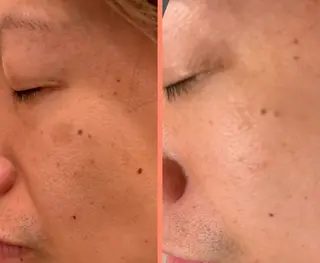 大阪大東市 / 体質・肌質改善サロン アンシャンテ所属・体質・肌質改善サロン アンシャンテのエステ・リラクイメージ