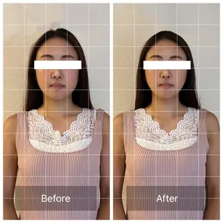 頭スッキリ疲労回復 ドライヘッドのエステ・リラクイメージ