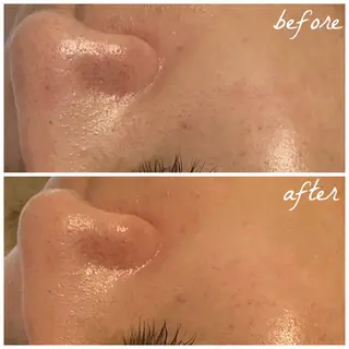 メンズ メナード岐阜市茜部 杉浦のエステ・リラクイメージ