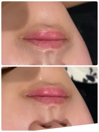 【リベルハーブピーリング認定店】敏感肌・美白脱毛専門店Dione立川店所属・Dione 立川店のエステ・リラクイメージ