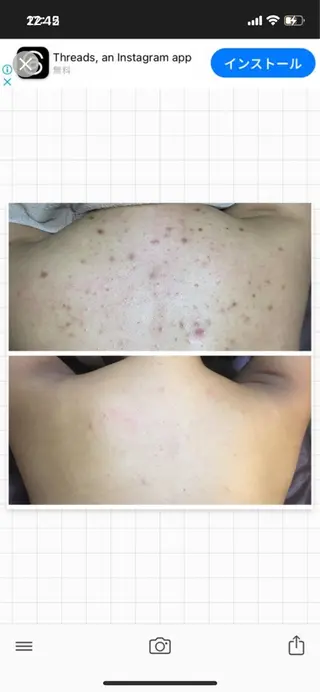 セミロング ハーブピーリング専門 🌿モッカのエステ・リラクイメージ