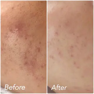 L’Beige レベージュのエステ・リラクイメージ