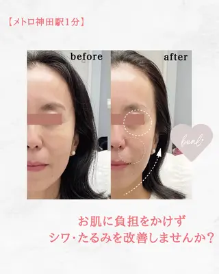 べアール所属・小顔/毛穴/ニキビ salon bealのその他イメージ
