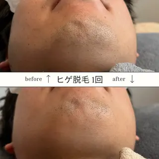 メンズ SKIN GYM所属・SKIN GYM メンズ専門脱毛サロンのエステ・リラクイメージ