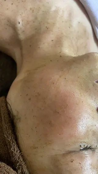 brilliance所属・老化肌トラブル肌専門 Brillianceのエステ・リラクイメージ