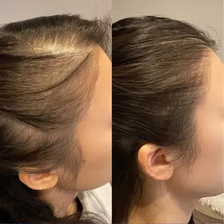 Blooming所属・LOUISE. ／肌質・頭皮のエステ・リラクイメージ