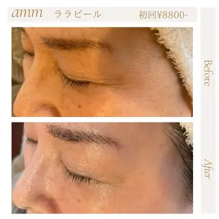 Amm所属・🏆艶肌ワックス🏆 ララピール✨Ammのエステ・リラクイメージ