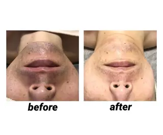 メンズ Beauty and Relaxation Salon N所属・Salon Nのエステ・リラクイメージ