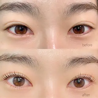 マツエク・マツパ schön所属・schön 松井のエステ・リラクイメージ