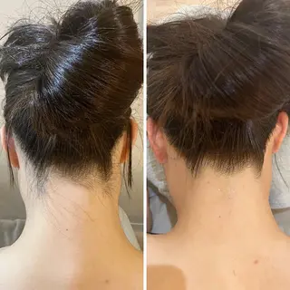 うなじ脱毛/美肌脱毛 LABELのエステ・リラクイメージ