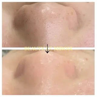 ビューティー ミロワールのエステ・リラクイメージ