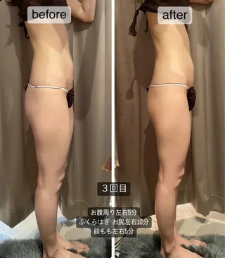 【痩身・脱毛サロン】 REBISKIN🌱のエステ・リラクイメージ