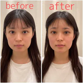 美容鍼サロンメゾンブランシェ所属・🌸美容鍼サロン🌸 メゾンブランシェ🌈のエステ・リラクイメージ