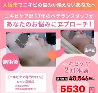 ニキビケア◇ニキビ跡 レゾン京橋店　八崎のエステ・リラクイメージ