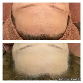 セミロング カラー パーマ ヘアアレンジ メンズ キッズ ネイル マツエク・マツパ アイブロウ ニキビ特化型エステ 🍓最短で肌質改善のエステ・リラクイメージ