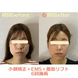 最速小顔・肌質管理 ❣️エスポワールのエステ・リラクイメージ