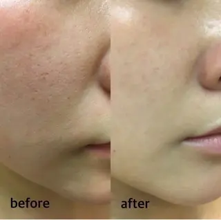 Beauty salonBellのエステ・リラクイメージ