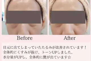 PRETTIEST SHINE所属・フェイシャル/ボディ /ブライダル山田浩子のエステ・リラクイメージ