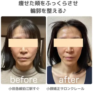 小顔矯正サロン　クレール所属・小顔矯正専門サロン クレールのエステ・リラクイメージ